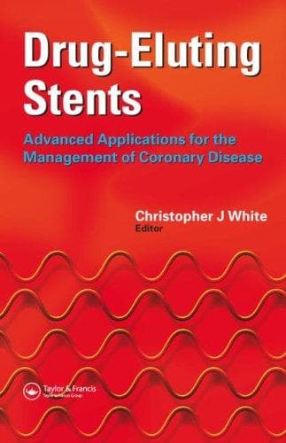 Tapa de Drug-Eluting Stents