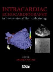 Tapa de Intracardiac Echocardiography in Interventional Electrophysiology