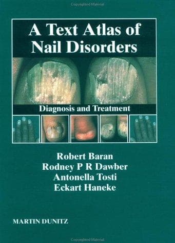 Tapa de Nail Disorders