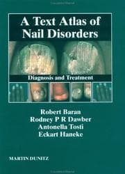 Tapa de Nail Disorders