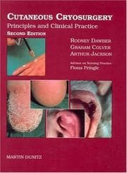 Tapa de Cutaneous Cryosurgery