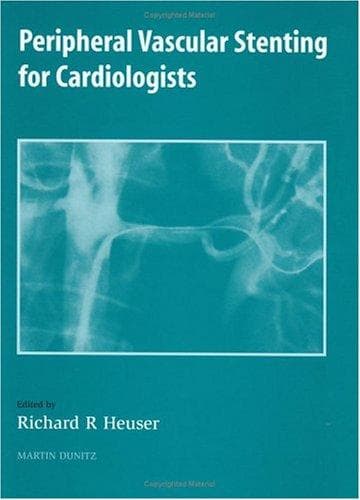 Tapa de Peripheral Vascular Stenting for Cardiologists