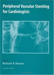Tapa de Peripheral Vascular Stenting for Cardiologists