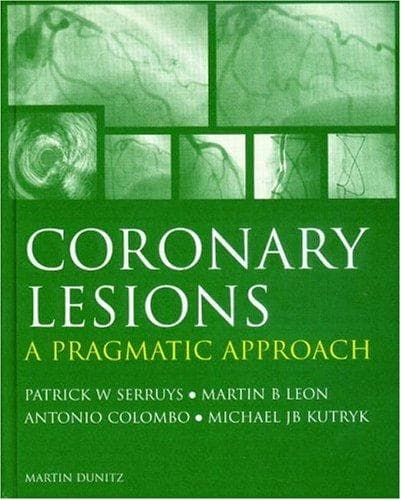 Tapa de Coronary lesions