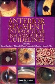 Tapa de Anterior segment intraocular inflammation (ASII)