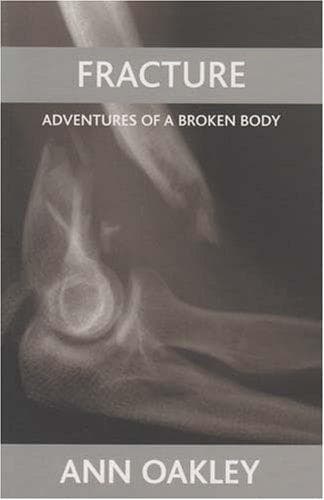 Tapa de Fracture