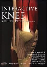 Tapa de Interactive Knee