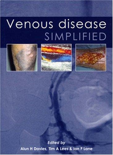 Tapa de Venous Disease Simplified