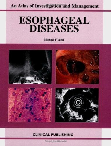 Tapa de Esophageal Diseases