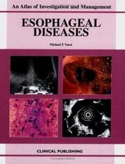 Tapa de Esophageal Diseases