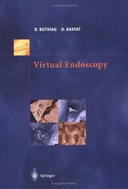 Tapa de Virtual endoscopy