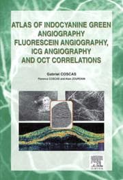 Tapa de Atlas of Indocyanine Green Angiography