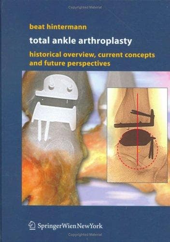 Tapa de Total Ankle Arthroplasty