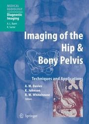 Tapa de Imaging of the hip & bony pelvis