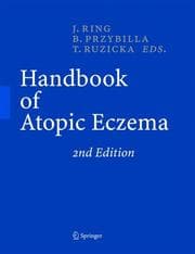 Tapa de Handbook of atopic eczema