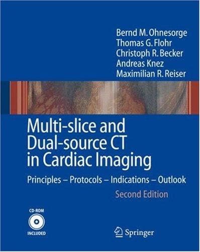 Tapa de Multi-slice and Dual-source CT in Cardiac Imaging
