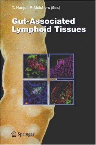 Tapa de Gut-Associated Lymphoid Tissues
