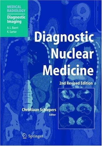 Tapa de Diagnostic nuclear medicine