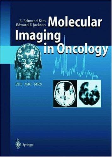 Tapa de Molecular imaging in oncology