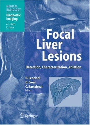 Tapa de Focal liver lesions