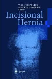 Tapa de Incisional hernia