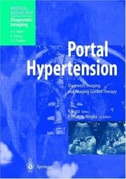 Tapa de Portal hypertension