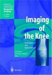 Tapa de Imaging of the knee
