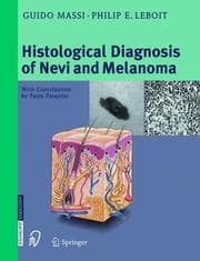 Tapa de Histological diagnosis of nevi and melanoma