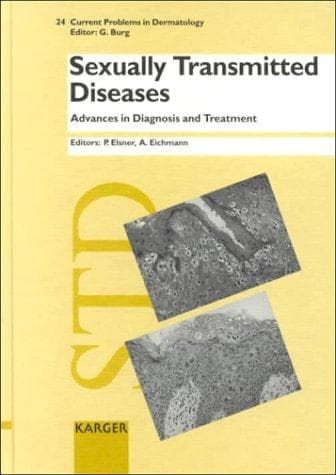 Tapa de Sexually transmitted diseases