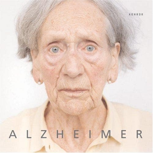 Tapa de Alzheimer