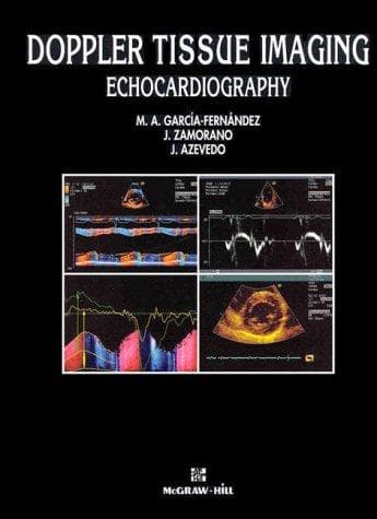 Tapa de Doppler tissue imaging echocardiography