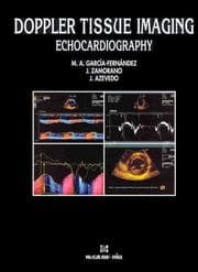 Tapa de Doppler tissue imaging echocardiography