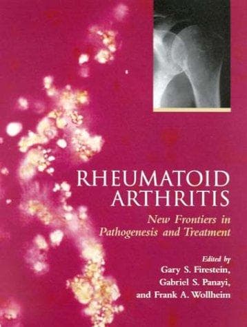 Tapa de Rheumatoid arthritis