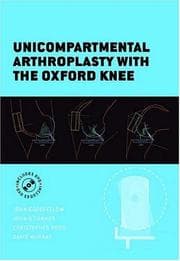 Tapa de Unicompartmental arthroplasty with the Oxford knee