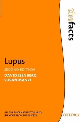Tapa de Lupus