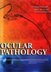 Tapa de Ocular Pathology