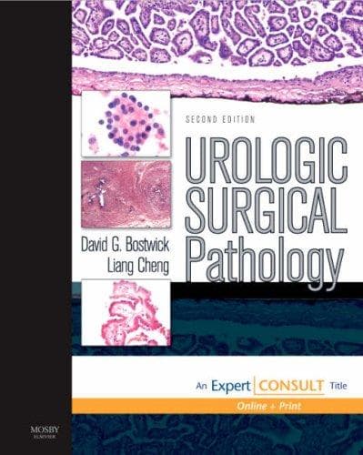 Tapa de Urological surgical pathology