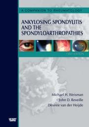 Tapa de Ankylosing spondylitis and the spondyloarthropathies