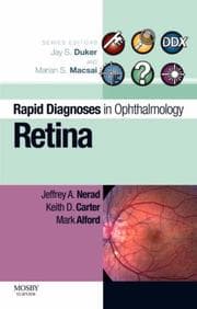 Tapa de Rapid Diagnosis in Ophthalmology Series: Retina