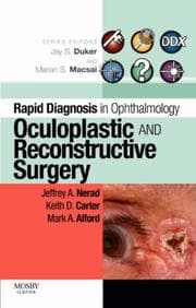 Tapa de Oculoplastic and reconstructive surgery