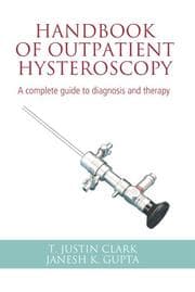 Tapa de Handbook of outpatient hysteroscopy
