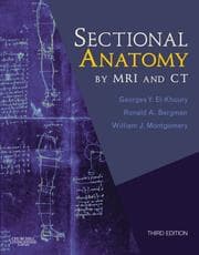 Tapa de Sectional Anatomy by MRI and CT