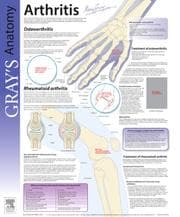 Tapa de Arthritis