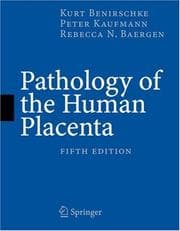Tapa de Pathology of the human placenta