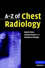 Tapa de A-Z of chest radiology