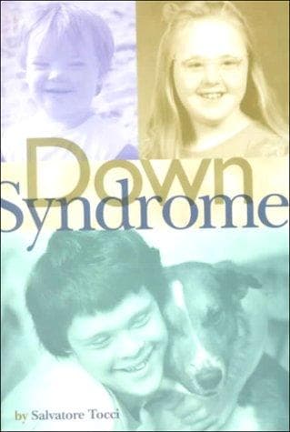 Tapa de Down Syndrome (Venture Book)