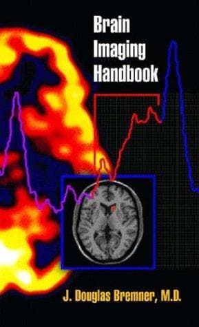 Tapa de Brain Imaging Handbook