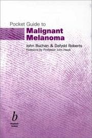 Tapa de Pocket Guide to Malignant Melanoma