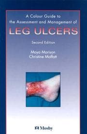 Tapa de Nursing Management of Leg Ulcers