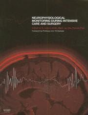 Tapa de Neurophysiological Monitoring During Intensive Care and Surgery